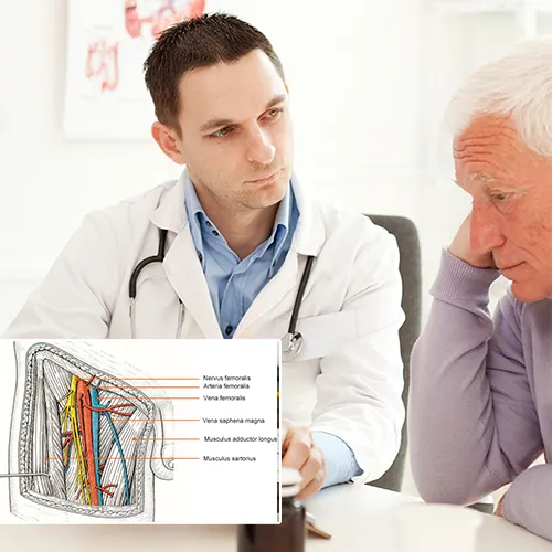 Urological Consultants of Florida 
: Ready to Serve Your Penile Implant Care Needs