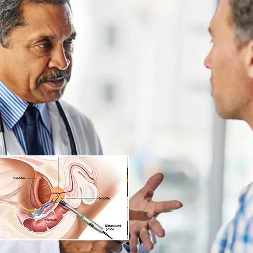 Comparing Penile Implants to Other ED Treatments